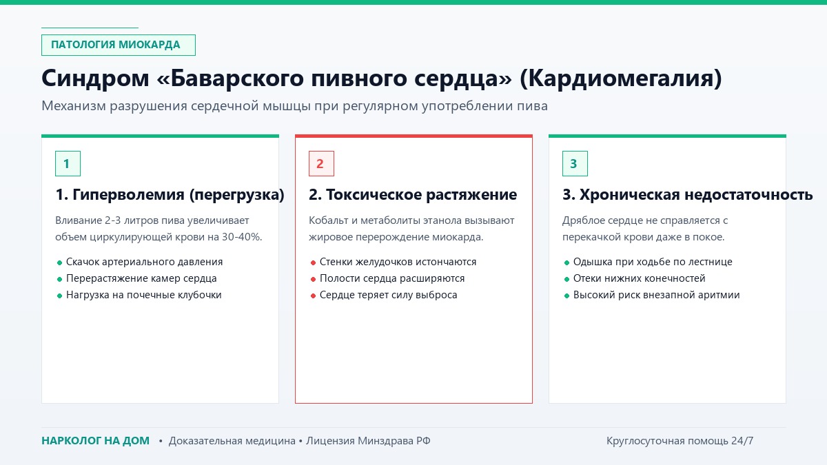 Синдром «Баварского пивного сердца» (Кардиомегалия)
